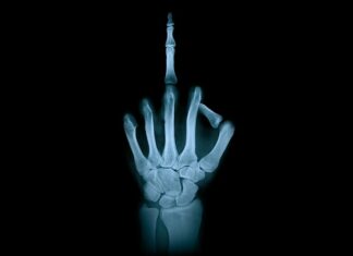 Kto przygotował 20 rentgenowskich ambulansów?